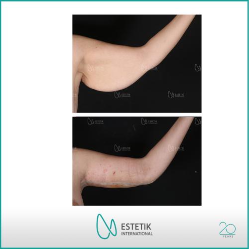 Before after photos of our patients 4