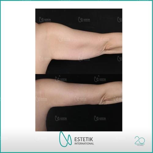 Before after photos of our patients 0