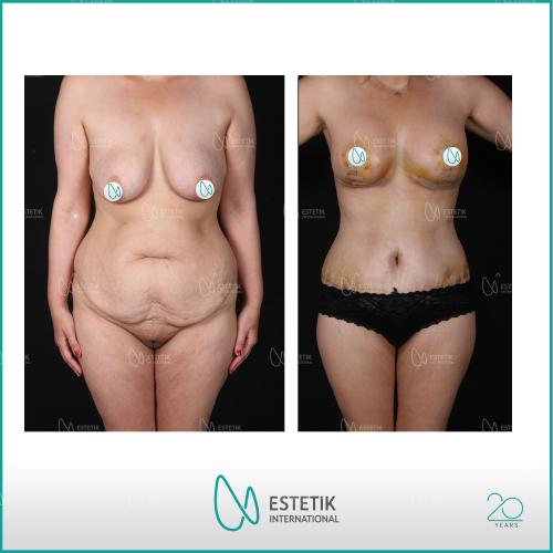 Before after photos of our patients 9