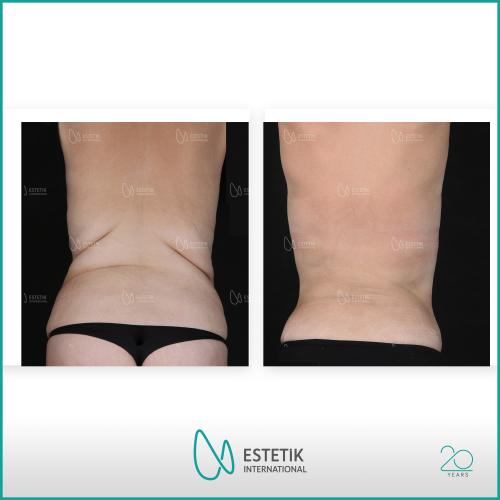 Before after photos of our patients 4
