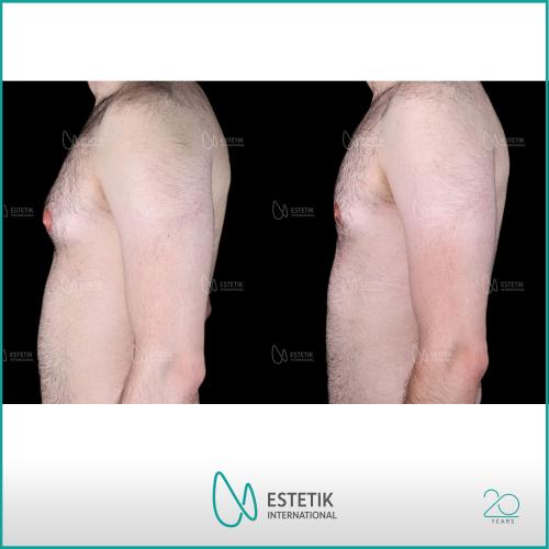 Before after photos of our patients 8