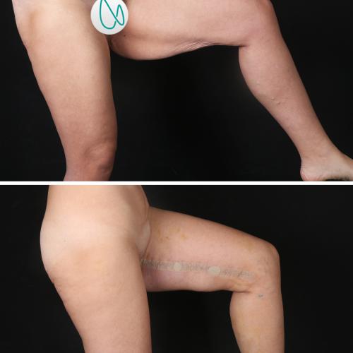 Before after photos of our patients 3