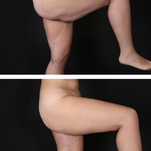 Before after photos of our patients 5