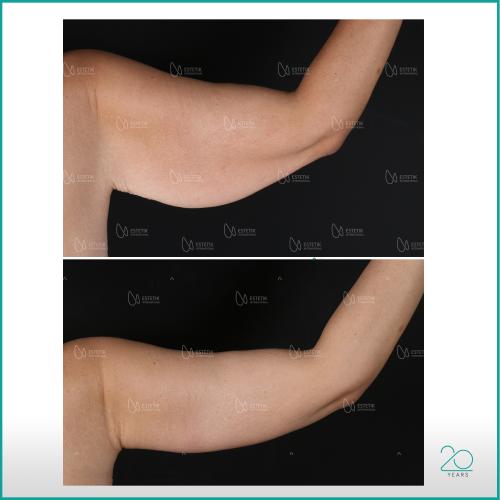 Before after photos of our patients 10