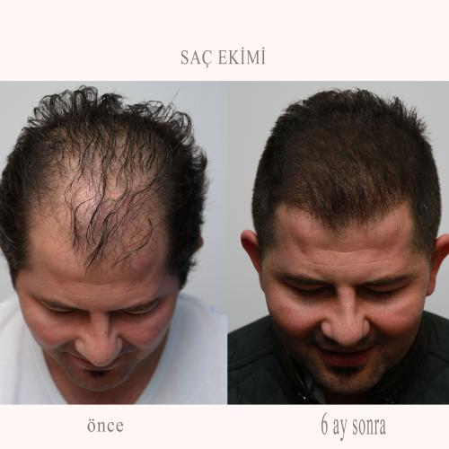 fotos antes y después de nuestros pacientes 3