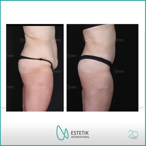 Before after photos of our patients 8