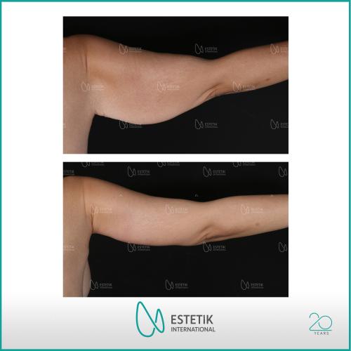 Before after photos of our patients 10