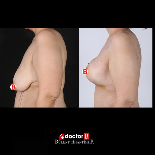 الجراحة التجميلية صور قبل وبعد