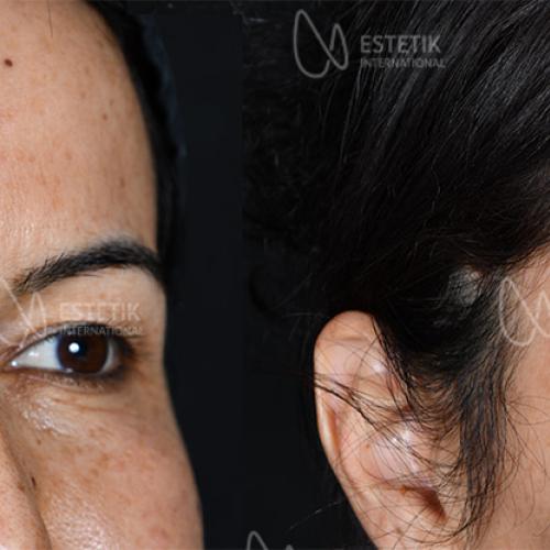 Before after photos of our patients 0