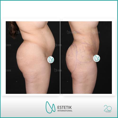 Before after photos of our patients 7