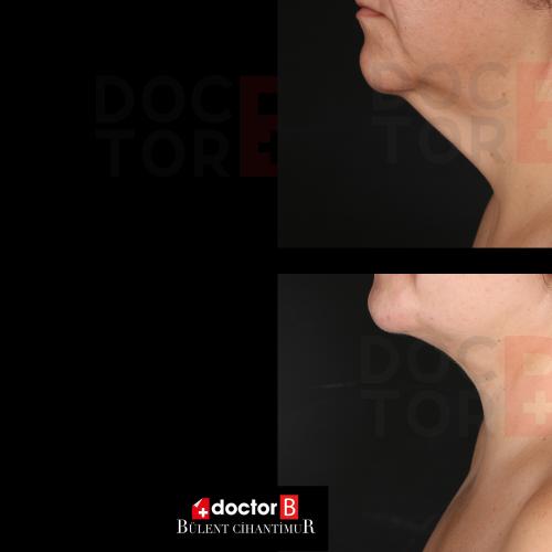 Before after photos of our patients 6