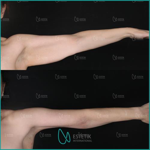 Before after photos of our patients 8
