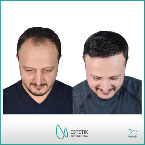 Пластическая и эстетическая хирургия Фотографии до и после