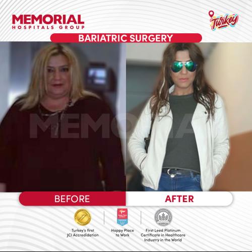Before after photos of our patients 11
