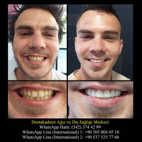 Dental care Before / After photo