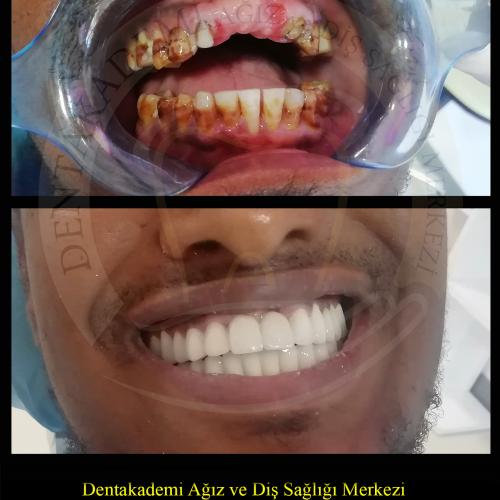 Before after photos of our patients 3