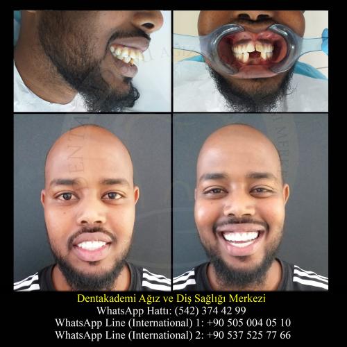 Dental care Before / After photo