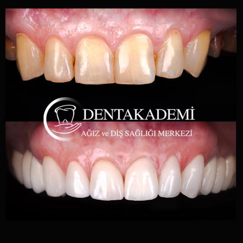 Before after photos of our patients 8