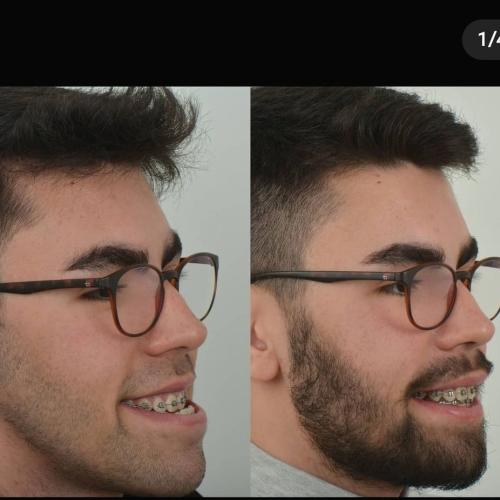 наших пациентов 11