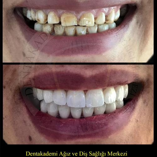 Before after photos of our patients 6