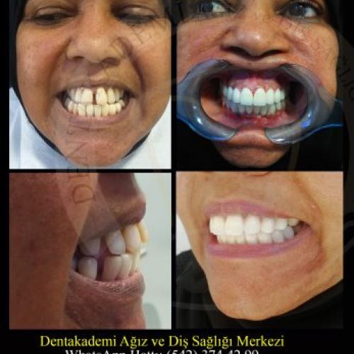 Before after photos of our patients 11