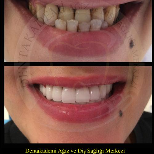 صور قبل وبعد لمرضانا 4