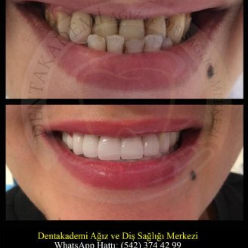 Before after photos of our patients 0