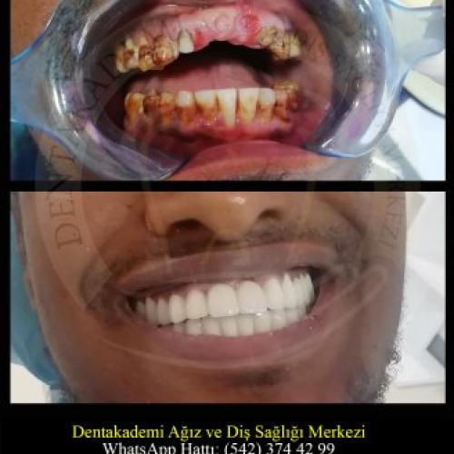 Before after photos of our patients 4