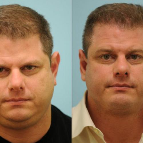 Before after photos of our patients 7