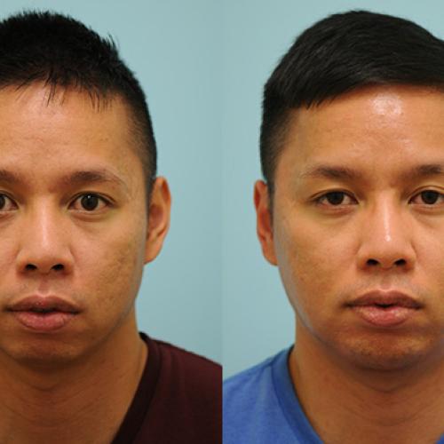 Before after photos of our patients 4
