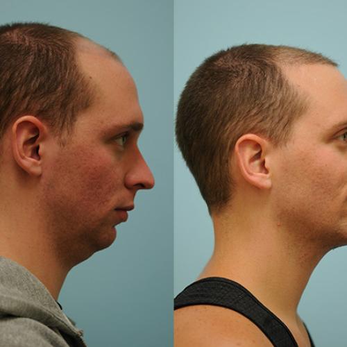 Before after photos of our patients 1