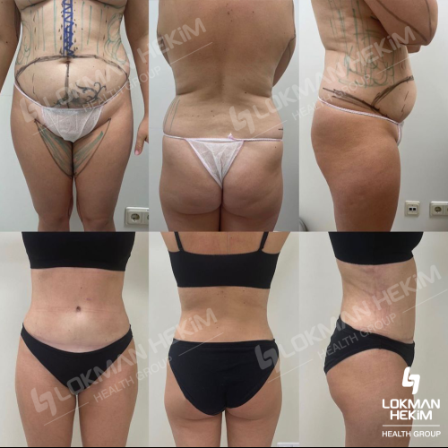 Before after photos of our patients 6