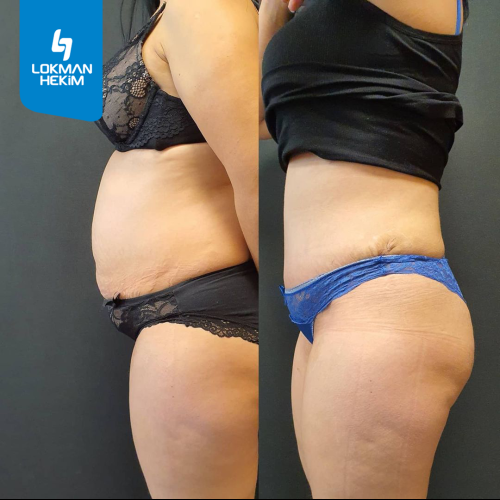 fotos antes y después de nuestros pacientes 8