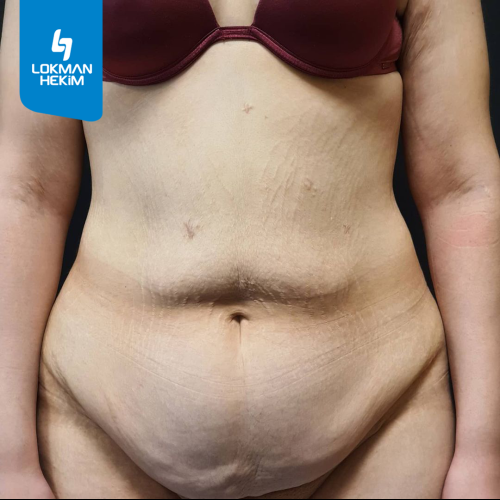 fotos antes y después de nuestros pacientes 1