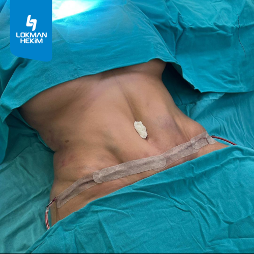 Before after photos of our patients 8