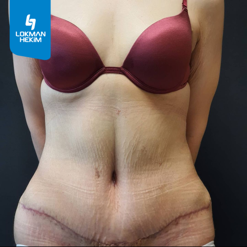 Before after photos of our patients 6