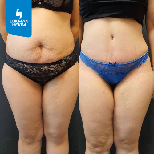 Before after photos of our patients 8