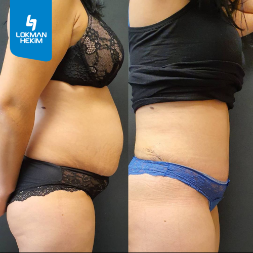 fotos antes y después de nuestros pacientes 11