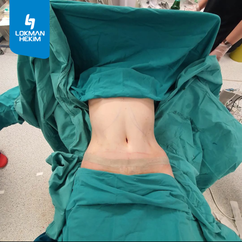 Before after photos of our patients 4