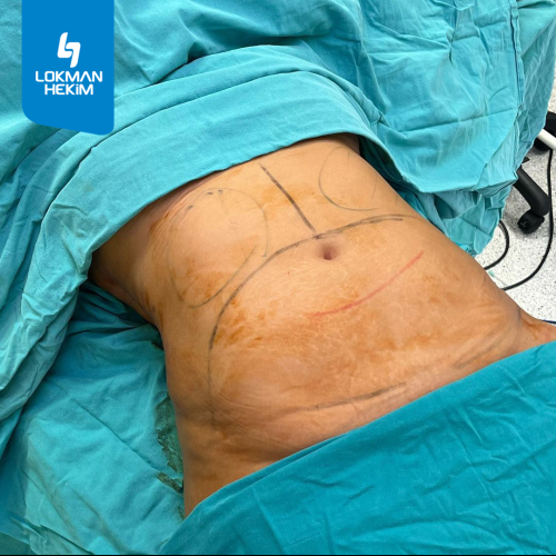 fotos antes y después de nuestros pacientes 8