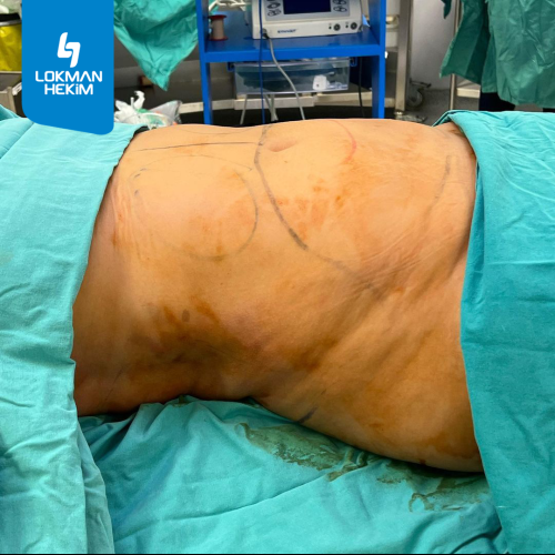 Before after photos of our patients 2