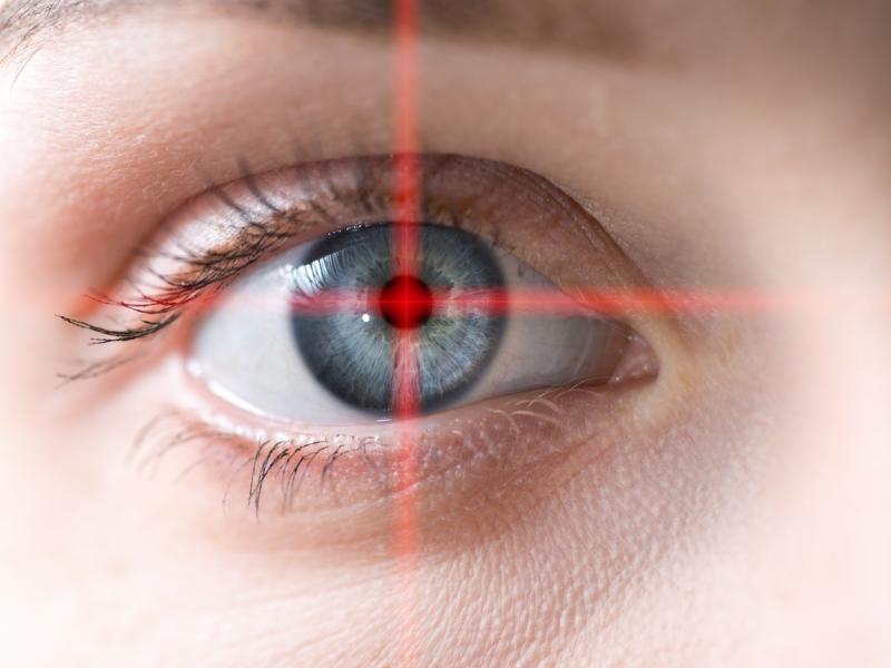 YAG Laser technique for eye treatment