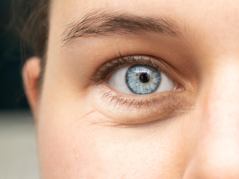 انتفاخ الجفون: كيف تحصلين على مظهر منتعش ونضر؟