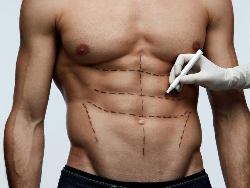 Why Abdominal Etching is not recommended for obese people?