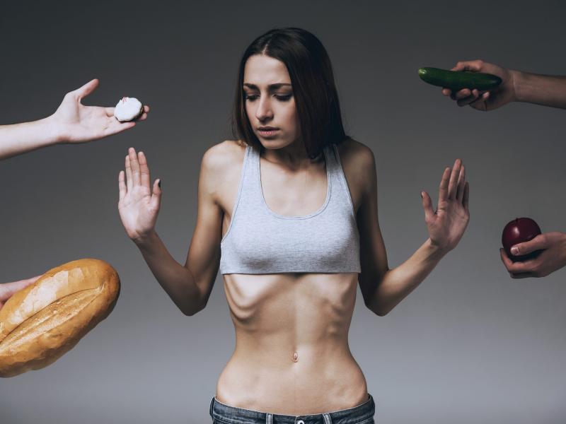 Anorexia Nervosa: Eating Disorder