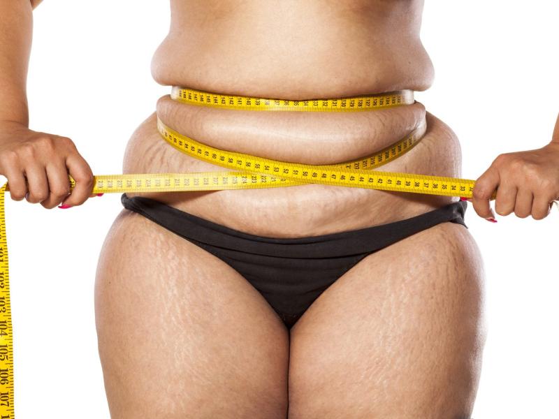 Перестать иметь лишний вес: это возможно!
