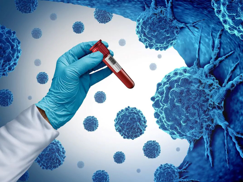 Detección genética: identificar la predisposición al cáncer para actuar a tiempo