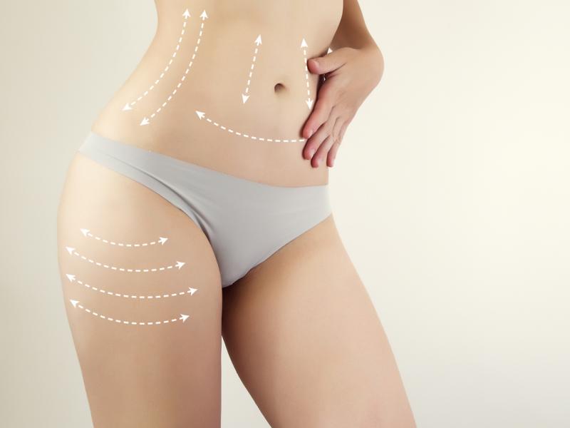 Liposuction and Liposculpture: What is the difference?