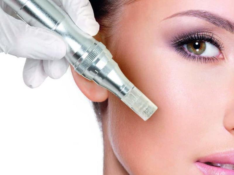 Microneedling and collagen production for a perfect skin