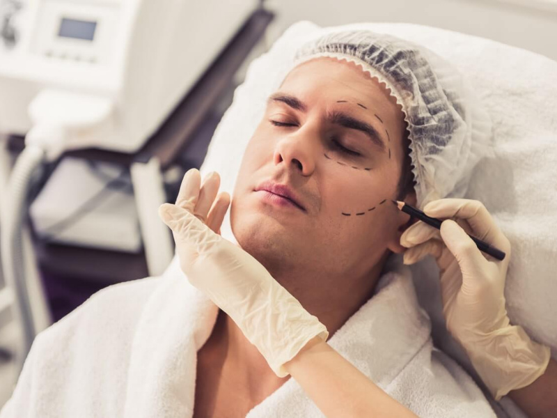 Chirurgie esthétique au masculin: Top des retouches les plus demandées par les hommes